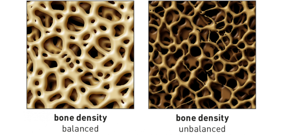 Bone density